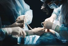 Mas é só uma cirurgia simples…” — é aí que mora o perigo