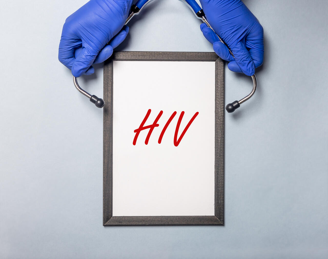 Prontuário médico pode omitir que o paciente tem HIV