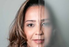 Lente de contato dental desgasta o dente
